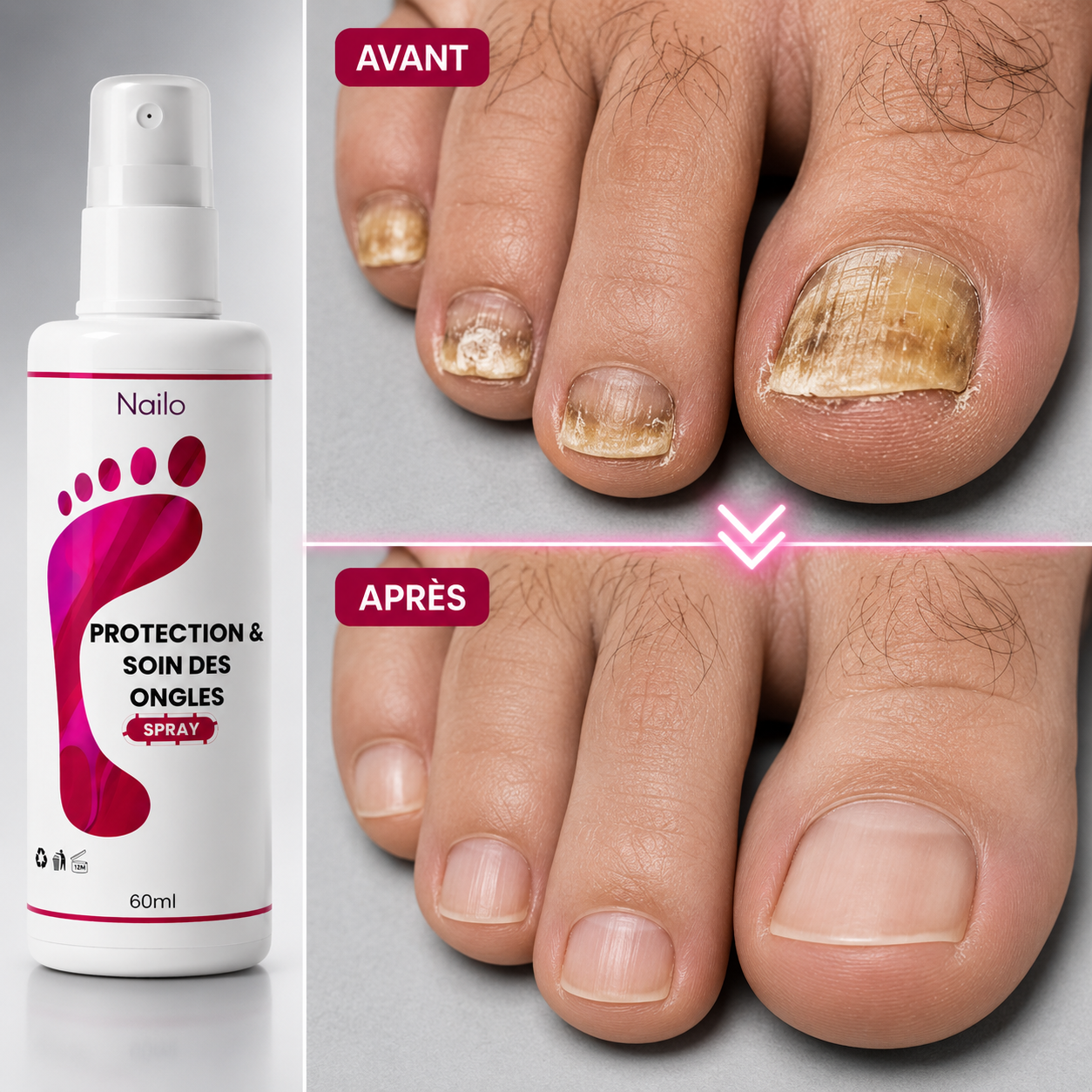 Nailo™ | Soin Fortifiant & Ongles Résistants